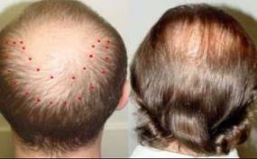  antes 19/3/12   -  Despues 19/7/12